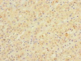 NPM2 antibody