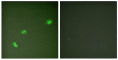 NPM (Phospho-Thr199) Antibody