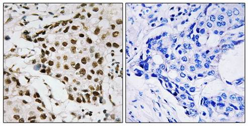 NPM (Phospho-Thr199) Antibody
