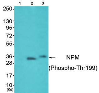 NPM (Phospho-Thr199) Antibody
