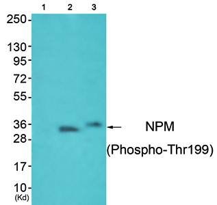 SOCS3 antibody