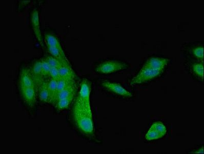 NPPB antibody