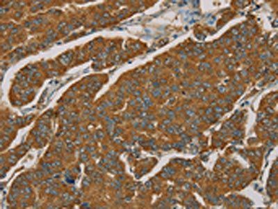NPPB Antibody