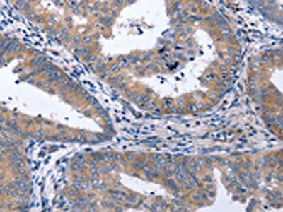NPPB Antibody