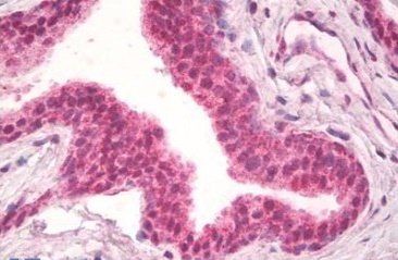 Goat anti-NPR3 (aa520-533) Antibody