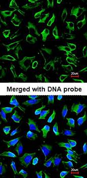 NPR-C antibody