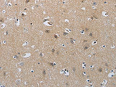 NPR1 Antibody