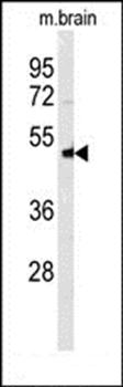 NPTX1-Y344 antibody