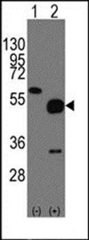 NPTX2 antibody