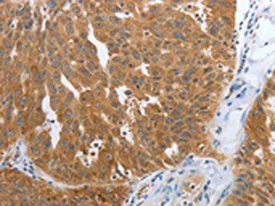 NPY1R Antibody