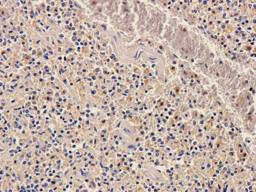 NPY1R antibody