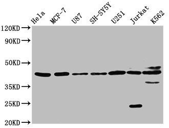 NPY2R antibody