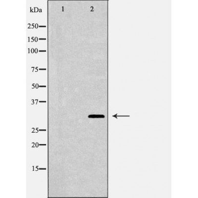 NQO1 Antibody