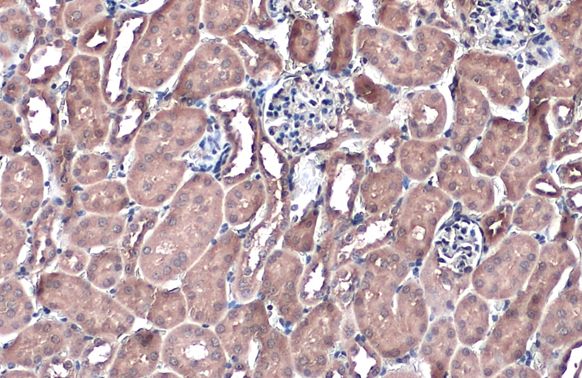 NQO1 antibody [C2C3], C-term