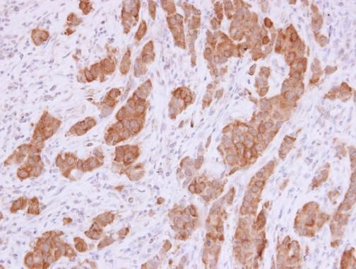 NQO1 antibody [C2C3], C-term