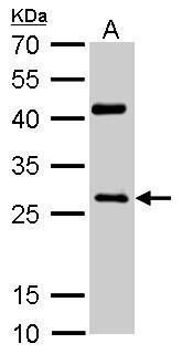 NQO1 antibody [C2C3], C-term