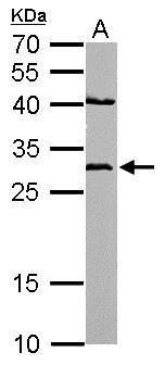 NQO1 antibody [C2C3], C-term