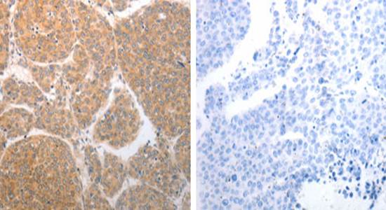 NQO1 Antibody