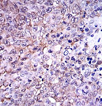 NQO1 Antibody