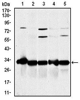 NQO1 Antibody