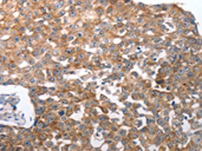 NQO2 Antibody