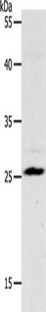 NQO2 antibody