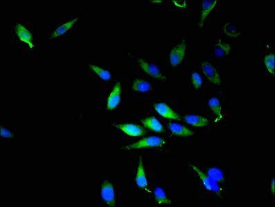 NQO2 Antibody