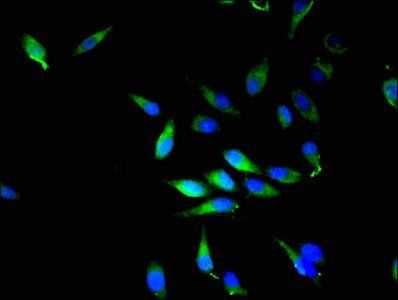 NQO2 antibody