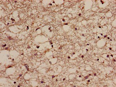 NQO2 Antibody