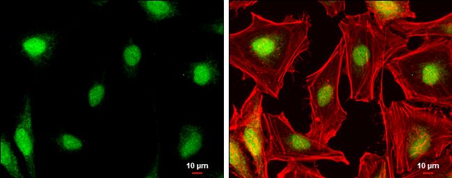 NR0B1 Rabbit Polyclonal Antibody