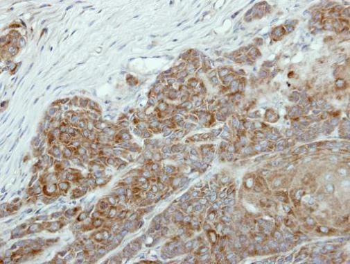NR0B1 Rabbit Polyclonal Antibody