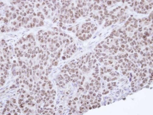NR0B2 antibody [N2C3]