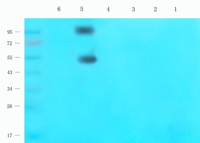 NR1I2 antibody