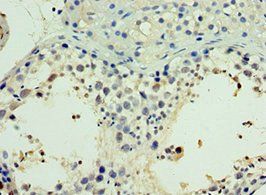 NR2C2 antibody