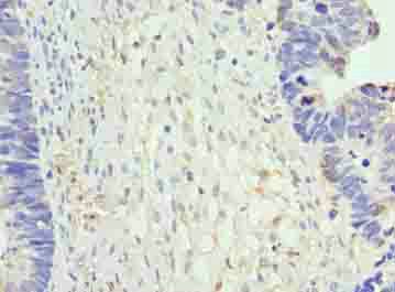 NR2C2AP Antibody
