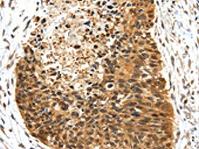NR2F2 Antibody