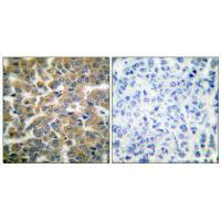 NR3C1 (Ab-211) Antibody