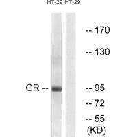 NR3C1 (Ab-211) Antibody