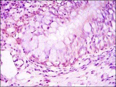 NR3C1 Antibody