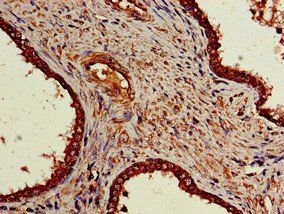 NR5A2 Antibody