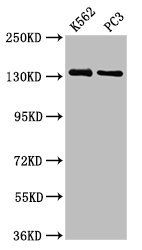 NRDC antibody