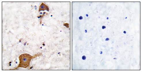 NRG1 isoform-10 Antibody