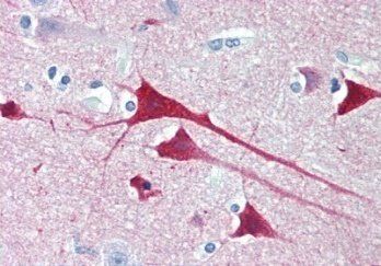Goat anti-Neurogranin precursor Antibody