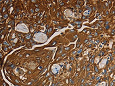 NRP1 Antibody