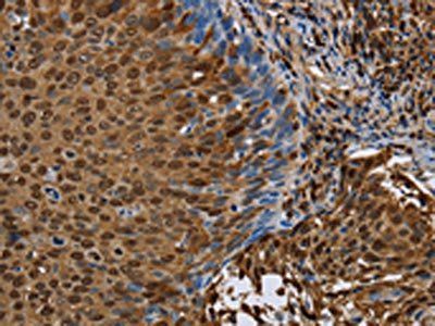 NRP2 Antibody