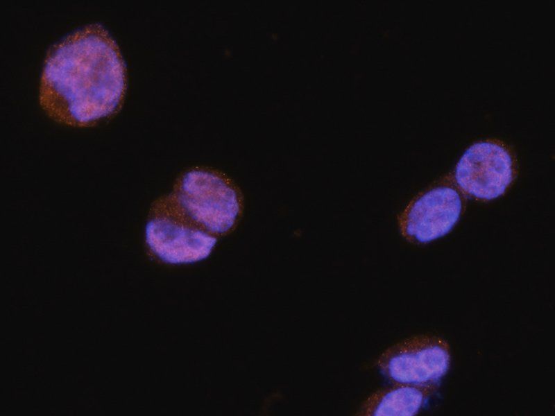 NRSF/REST antibody