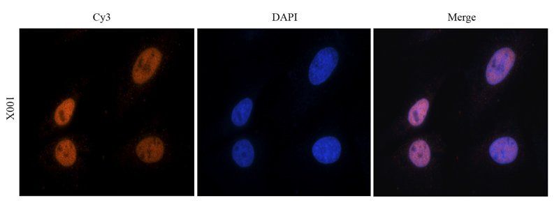 NRSF/REST antibody