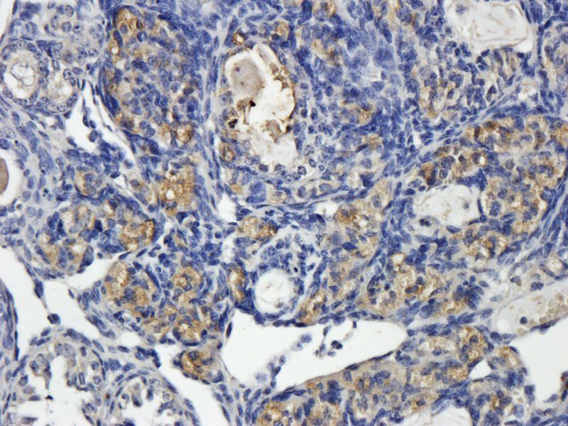 NRSF/REST antibody