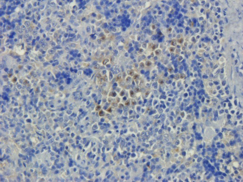 NRSF, REST Protein antibody