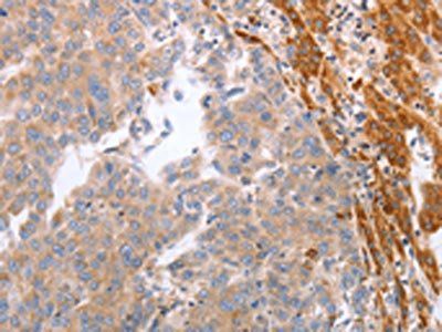 NRTN Antibody